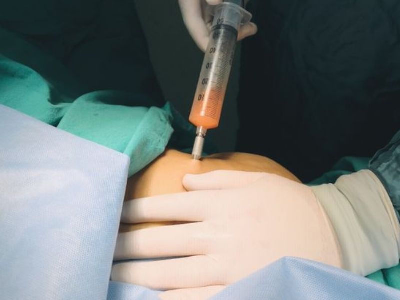 Regenerative Medicine